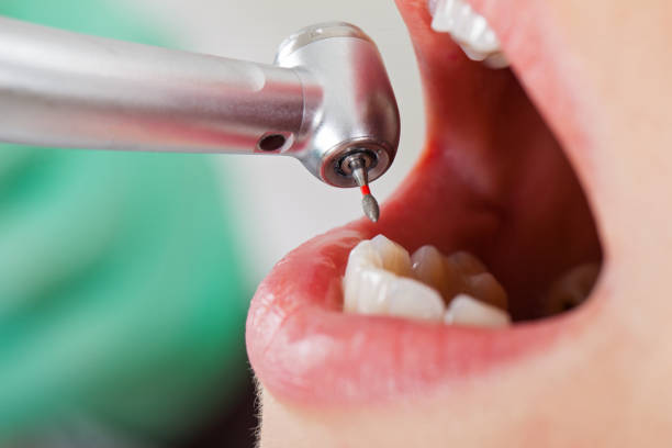Best After-Hours Emergency Dentist in Old River Winfree, TX